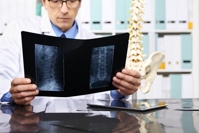 تصویربرداری اشعه ایکس برای دیسک گردن