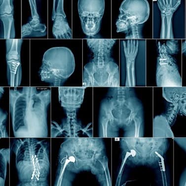 اشعه ایکس چیست؟